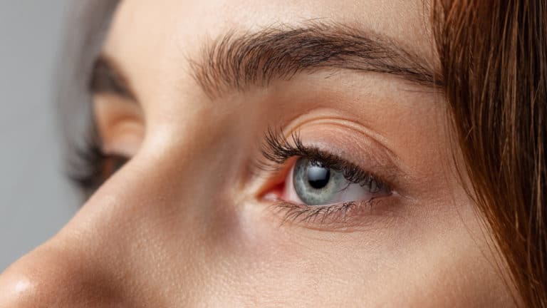 What Causes Dry Eyes?