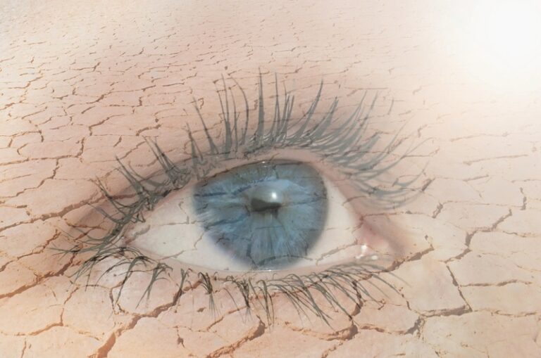 What Are the Symptoms of Dry Eye Syndrome?
