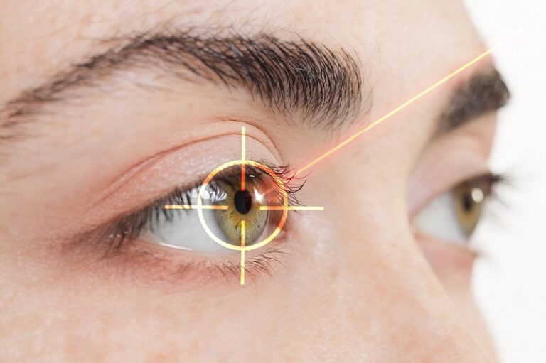 How Long Is a LASIK Surgery?