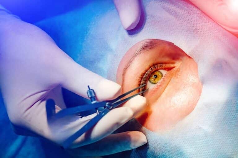 Refractive Correction At What Age Can I Get a Refractive Lens Exchange?