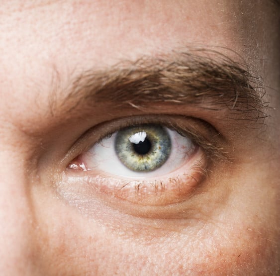 What Vision Problems Can LASIK Surgery Correct?