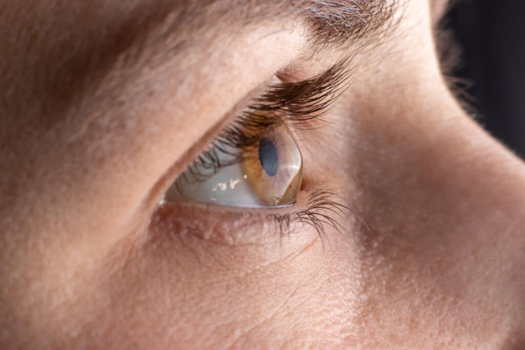 Lasik Edmonton & Northern Alberta - Visionmax Eye Centre Lasik Edmonton & Northern Alberta