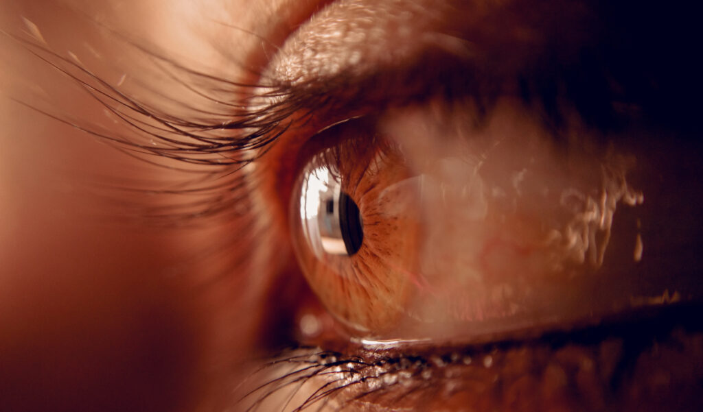 Laser Eye Surgery, Edmonton & Northern Alberta - Visionmax Eye Centre Laser Eye Surgery, Edmonton & Northern Alberta